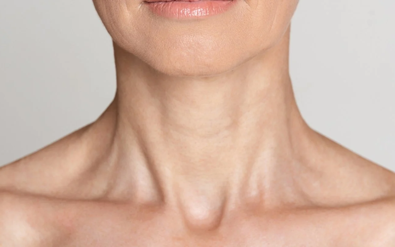 Protocolo Power NecK